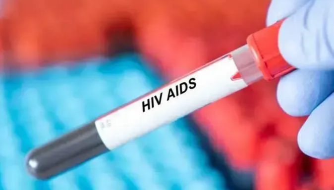 Kocaeli’de HIV vakaları artıyor!