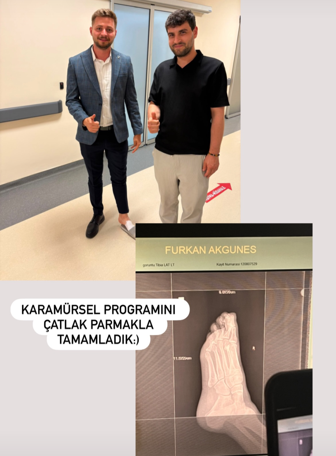 Acıya Rağmen Durmadı! Furkan Akgüneş Programını Çatlak Parmakla Tamamladı